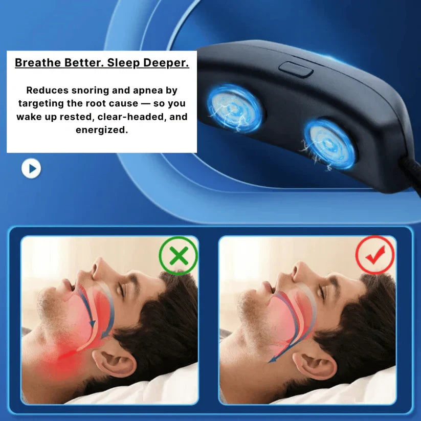 Sleep Clear | Anti Snoring Neurostimulation Device👏